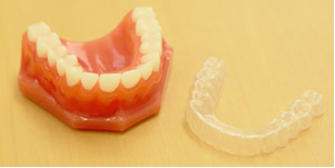 マウスピース型カスタム矯正歯科装置